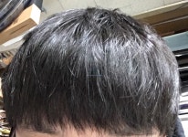 이식 8개월반차 사진입니다 이식8개월반차사진입니다