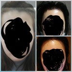 라인좀 봐주세요 [NHI뉴헤어] 라인좀 봐주세요 | 모발이식 후기,리뷰,비용은 대다모!