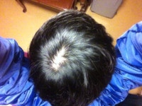 이씨PUBLISHINGCO.KOREA | [Fuck Hair Loss] 이 씨X 발모차고 나발이고 약이다 | Korea's No.1 Hair Loss Community, DAEDAMO [Fuck Hair Loss] 이 씨X...