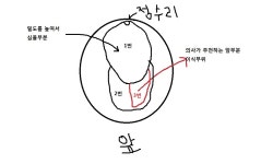 [고민상담] 조만간 이식수술을 앞두고있는데 이식밀도가 고민입니다 | 대한민국 1등 탈모 커뮤니티 대다모