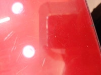 원형탈모 재발 !  빠진머리에 노란이물질이있습니다 원형탈모재발빠진머리에노란이물질이있습니다