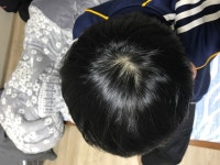 [고민상담] 연모화와 수술관련 고민상담 연모화와 수술관련