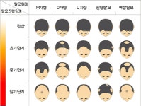 홍콩할배의 유전탈모 비유전탈모 그외의 추가 내용. 홍콩할배의유전탈모비유전탈모그외의추가내용
