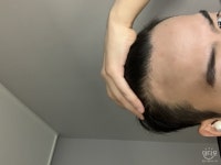 하 심어야하나 말아야하나 고민되네요 하심어야하나말아야하나고민되네요