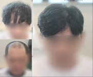 광주쓰리업위그 투블럭가르마펌 스타일 [남성맞춤가발] 광주쓰리업위그 투블럭가르마펌 스타일