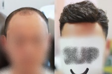 광주쓰리업위그 가발로 포마드펌 스타일 선택시 주의할점은? [부분가발] 광주쓰리업위그 가발로 포마드펌 스타일 선택시 주의할점은? | 모발이식... 