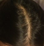 [Worry Talk] 정수리 사진 찍어봤어요 | Koreas No.1 Hair Loss Community, DAEDAMO