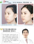 [건강]‘이목구비 미인’ 가고 ‘입체 미인’ 뜬다｜동아일보 [건강]‘이목구비 미인’ 가고 ‘입체 미인’ 뜬다