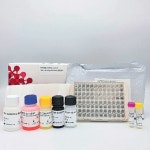 [헬스캡슐]SG메디칼, 코로나 중화항체 진단 검사키트 본격 수출 外｜동아일보 [헬스캡슐]SG메디칼, 코로나 중화항체 진단 검사키트 본격 수출 外