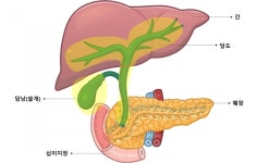 “조기 발견 어렵고 재발 잦은 ‘담도암’…면역 항암제 병용요법으로... 어렵고 재발 잦은 ‘담도암’…면역 항암제 병용요법으로 생존율 증가”