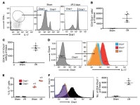 JCI - Calcium channel Orai1 promotes lymphocyte IL-17 expression and progressive kidney injury