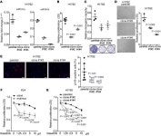 JCI - The Mir181ab1 cluster promotes KRAS-driven oncogenesis and progression in lung and pancreas