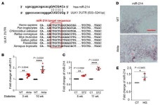JCI - p53/microRNA-214/ULK1 axis impairs renal tubular autophagy in diabetic kidney disease