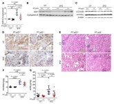 JCI - p53/microRNA-214/ULK1 axis impairs renal tubular autophagy in diabetic kidney disease