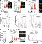 JCI - RNF168 regulates R-loop resolution and genomic stability in BRCA1/2-deficient tumors