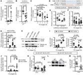 JCI - Hypoxia-inducible factor–1α–dependent induction of miR122 enhances hepatic ischemia tolerance