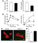 JCI - PKCλ regulates glucose-induced insulin secretion through modulation of gene expression in pancreatic β cells