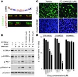 JCI - Blocking airway mucous cell metaplasia by inhibiting EGFR antiapoptosis and IL-13 transdifferentiation signals
