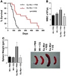 JCI - Targeting lysosomal degradation induces p53-dependent cell death and prevents cancer in mouse models of lymphomagenesis