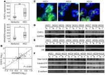 JCI - CHD1L promotes hepatocellular carcinoma progression and metastasis in mice and is associated with these processes in human... 