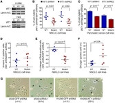 JCI - Wilms tumor 1 (WT1) regulates KRAS-driven oncogenesis and senescence in mouse and human models