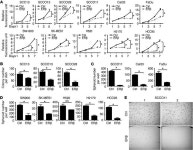 JCI - Multifactorial ERβ and NOTCH1 control of squamous differentiation and cancer