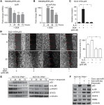 JCI - IL-6R/STAT3/miR-34a feedback loop promotes EMT-mediated colorectal cancer invasion and metastasis