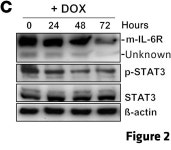JCI - IL-6R/STAT3/miR-34a feedback loop promotes EMT-mediated colorectal cancer invasion and metastasis