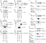 JCI - Uropathogenic Escherichia coli strain CFT073 disrupts NLRP3 inflammasome activation