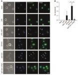 JCI - Uropathogenic Escherichia coli strain CFT073 disrupts NLRP3 inflammasome activation