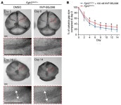 JCI - Tyrosine kinase inhibitor NVP-BGJ398 functionally improves FGFR3-related dwarfism in mouse model