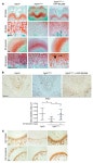 JCI - Tyrosine kinase inhibitor NVP-BGJ398 functionally improves FGFR3-related dwarfism in mouse model