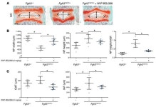 JCI - Tyrosine kinase inhibitor NVP-BGJ398 functionally improves FGFR3-related dwarfism in mouse model