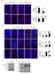 JCI - Inhibition of CDK4/6 protects against radiation-induced intestinal injury in mice