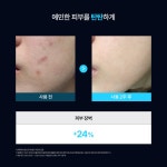 닥터리코스(DR.LEECOS) [Dr. EP] 닥터EP 스킨부스터 뷰티 홈케어 디바이스 + 헤어밴드 증정 - 후기 | 무신사