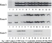 [PDF] Frequent abnormalities of the putative tumor suppressor gene FHIT at 3p14.2 in pancreatic carcinoma cell lines. | Semantic... 