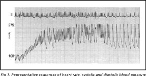 [PDF] Hemodynamic parameters and neurogenic pulmonary edema following spinal cord injury: an experimental model. | Semantic Scholar