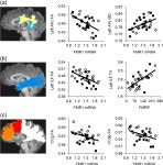 [PDF] Influence of the fragile X mental retardation (FMR1) gene on the brain and working memory in men with normal FMR1 alleles... 
