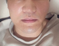 지온메디텍 듀얼소닉 이펙트 - 에누리 가격비교