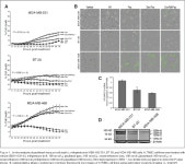 [PDF] Glucocorticoid Receptor Antagonism as a Novel Therapy for Triple-Negative Breast Cancer | Semantic Scholar