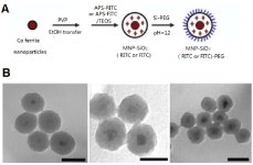 [PDF] Superparamagnetic Iron Oxide Nanoparticles as MRI contrast agents for Non-invasive Stem Cell Labeling and Tracking... 