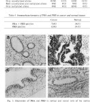 [PDF] Progesterone receptor B gene inactivation and CpG hypermethylation in human uterine endometrial cancer. | Semantic Scholar