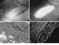 Adipose-derived stem cells for tissue repair and regeneration: ten years of research and a literature review. | Semantic Scholar