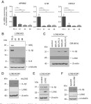 [PDF] Lipocalin-2 (LCN2) Deficiency Leads to Cellular Changes in Highly Metastatic Human Prostate Cancer Cell Line PC-3... 