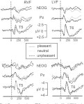 Effects of emotional arousal in the cerebral hemispheres: a study of oscillatory brain activity and event-related potentials... 