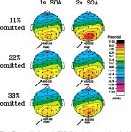 [PDF] The ERP omitted stimulus response to “no-stim” events and its implications for fast-rate event-related fMRI designs... 