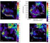 [PDF] First high-resolution radio study of the supernova remnant G338.3-0.0 associated with the gamma-ray source HESS J1640-465... 
