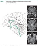 Aquaporin-4, homeostasis, and neurologic disease | Semantic Scholar