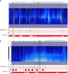 [PDF] Preoperative physiological esophageal assessment for anti-reflux surgery: A guide for surgeons on high-resolution manometry... 