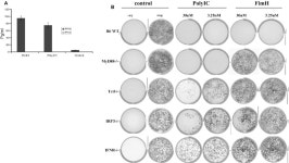 [PDF] FimH Adhesin of Type 1 Fimbriae Is a Potent Inducer of Innate Antimicrobial Responses Which Requires TLR4 and Type 1...